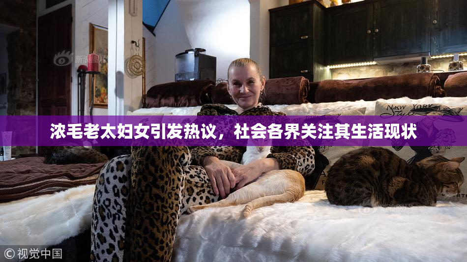 浓毛老太妇女引发热议，社会各界关注其生活现状