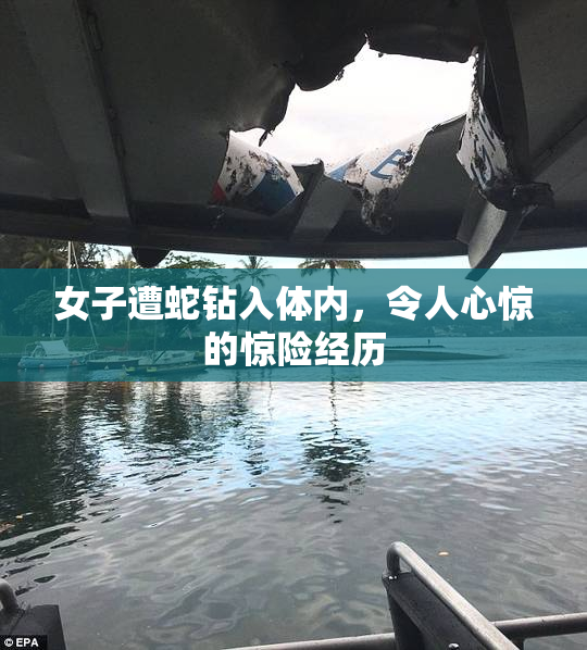 女子遭蛇钻入体内，令人心惊的惊险经历
