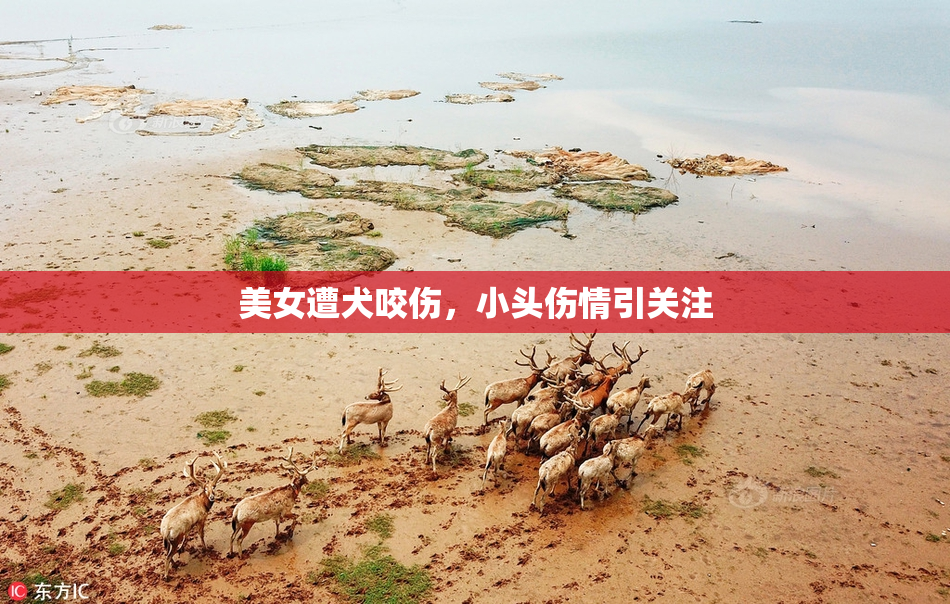 美女遭犬咬伤，小头伤情引关注