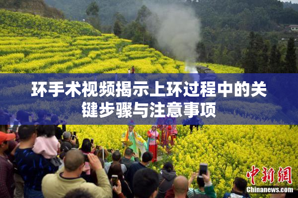环手术视频揭示上环过程中的关键步骤与注意事项