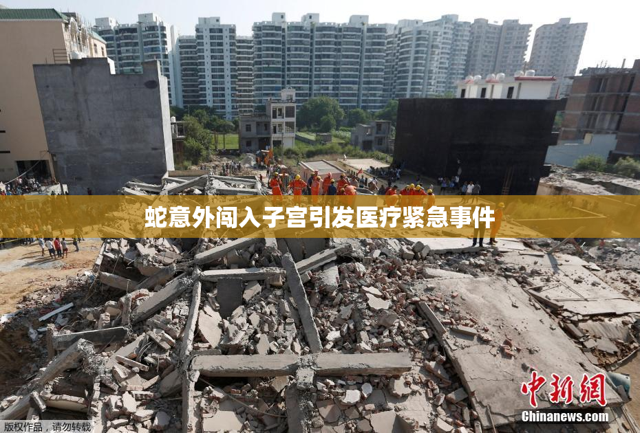 蛇意外闯入子宫引发医疗紧急事件