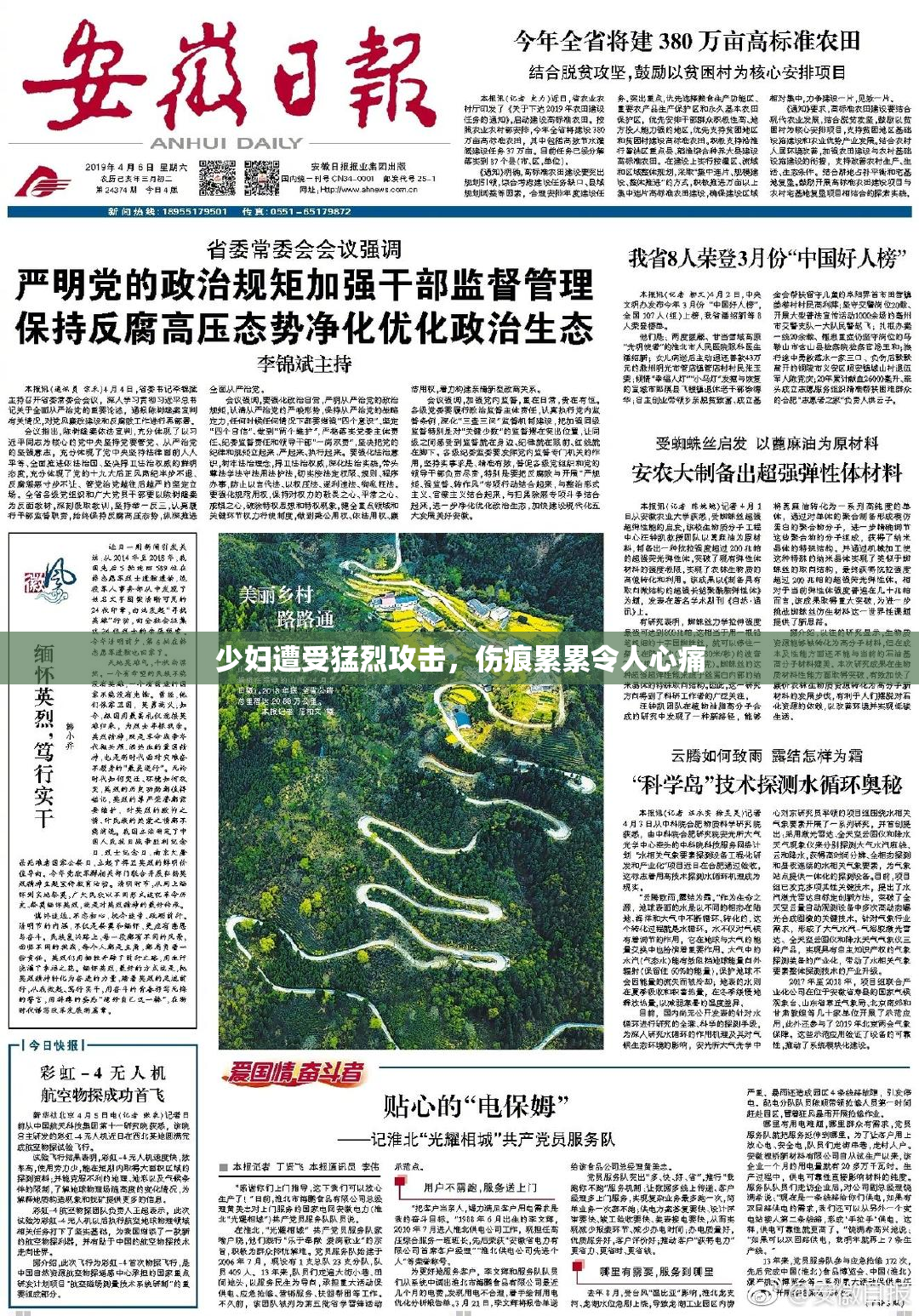 少妇遭受猛烈攻击，伤痕累累令人心痛