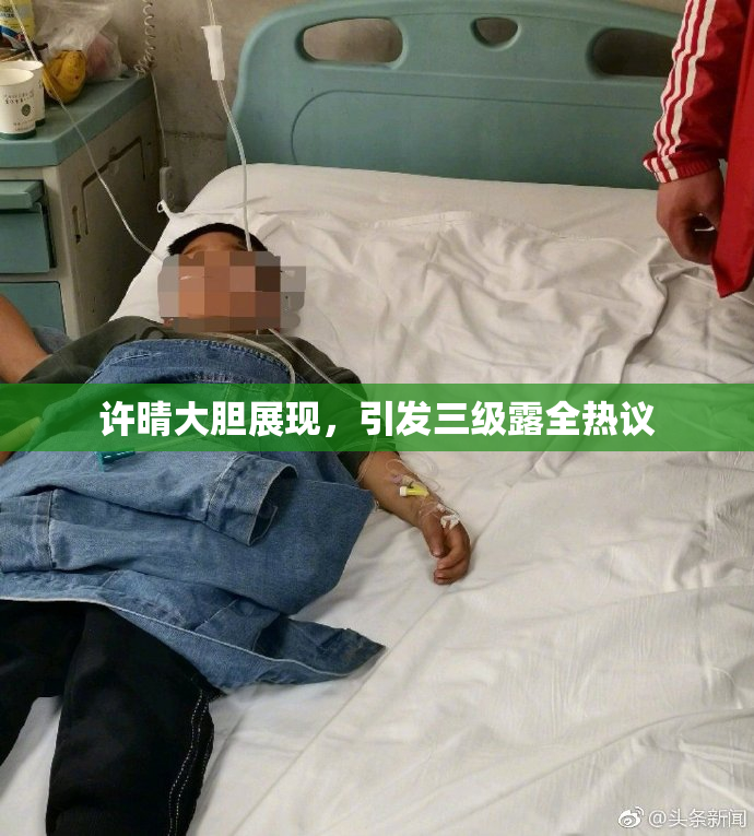 许晴大胆展现，引发三级露全热议