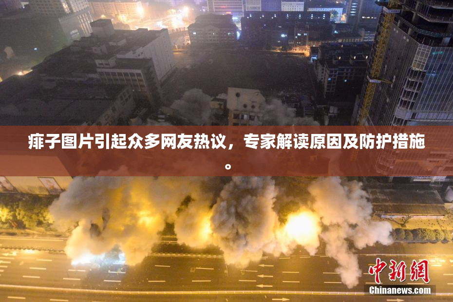 痱子图片引起众多网友热议，专家解读原因及防护措施。