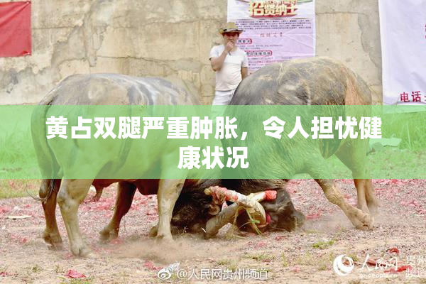 黄占双腿严重肿胀，令人担忧健康状况