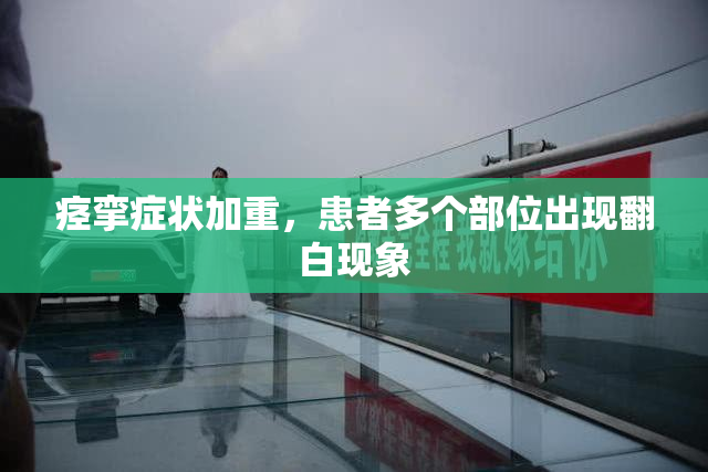 痉挛症状加重，患者多个部位出现翻白现象