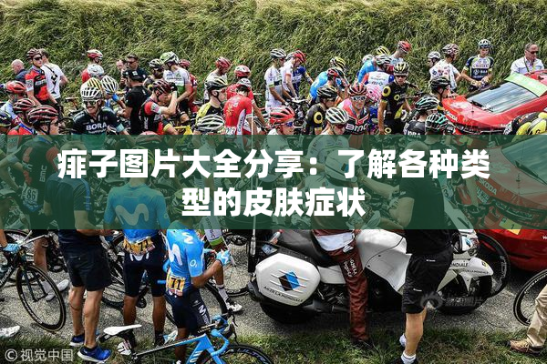 痱子图片大全分享：了解各种类型的皮肤症状